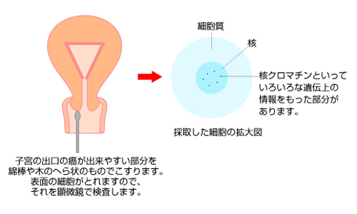 宮頸 ん 子 確率 が 再 検査 子宮頸がん検査の結果が「要精密検査」だった方へ