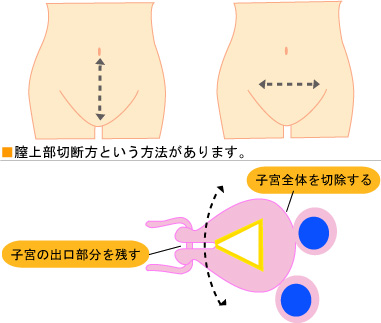 生理前 子宮が下がる