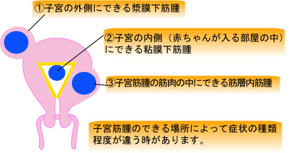 手術 リスク 筋腫 子宮 子宮筋腫の手術で保険はおりる？アフラックや県民共済の場合を解説